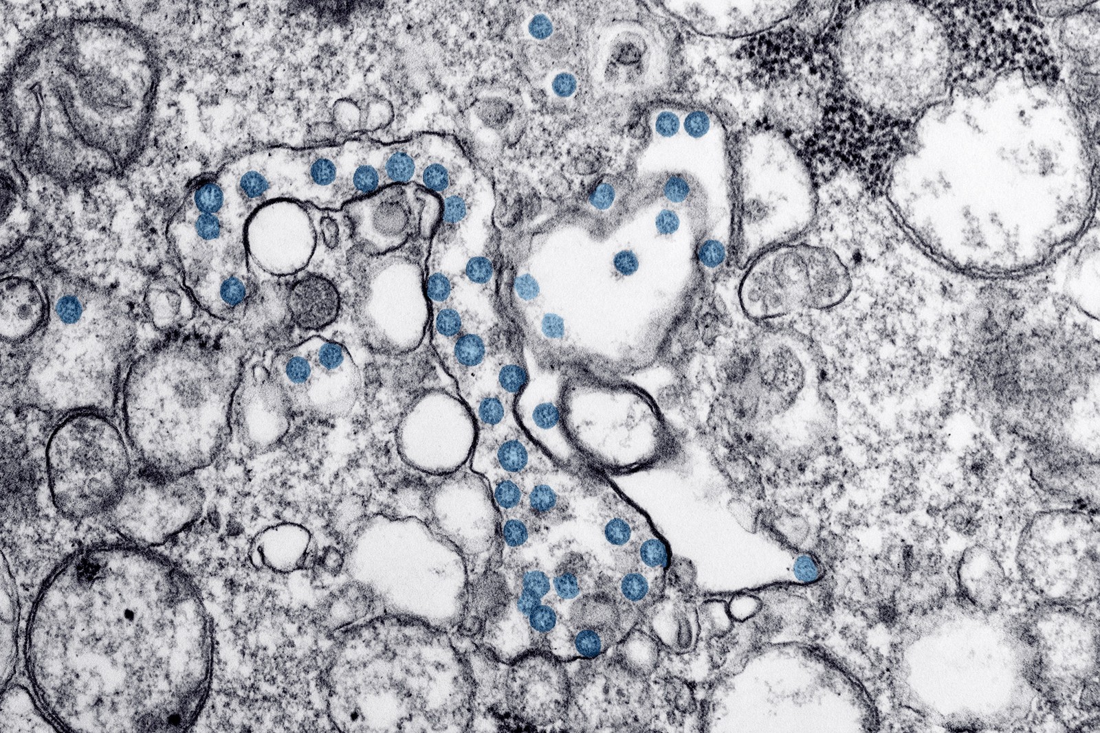 Covid-19 se espalhou pelo mundo mais devagar do que o H1N1, aponta levantamento